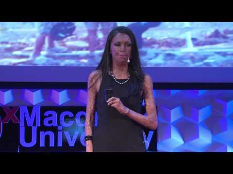 Turia Pitt, keynote speaker